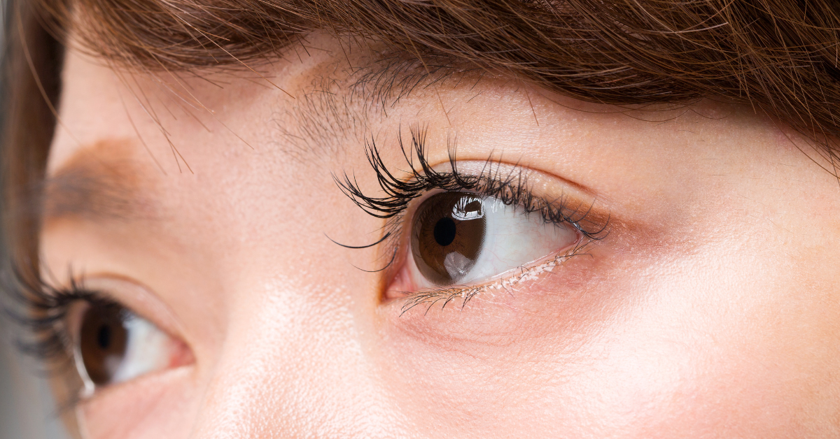 シワ,小じわ,目,ヒアルロン酸,針,パッチ